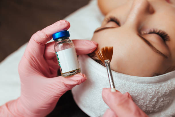 Chemical Peel at Lloyds Medical Group