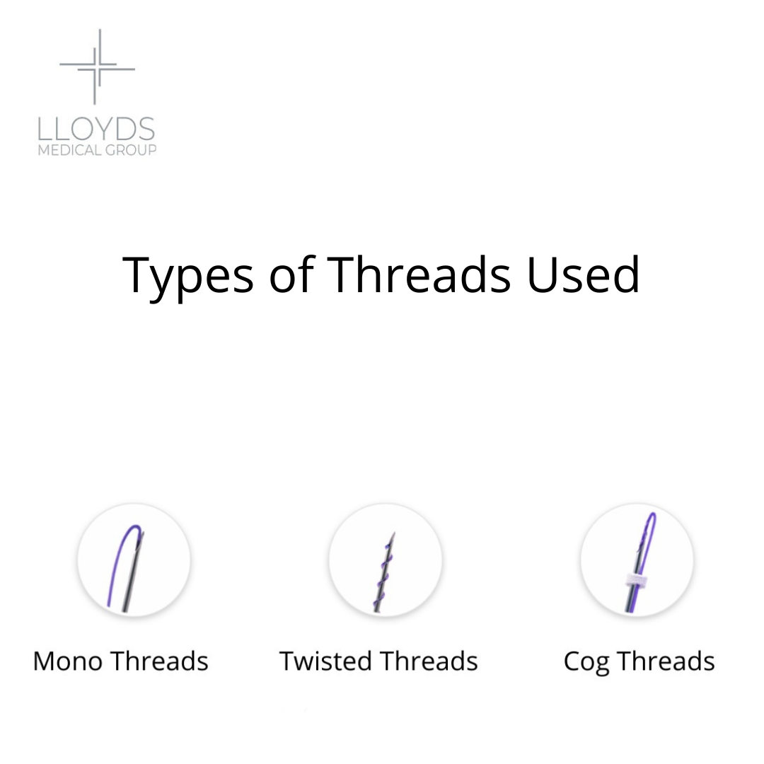 Types of Threads Used