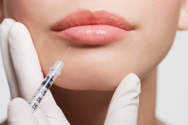 Botox® injections